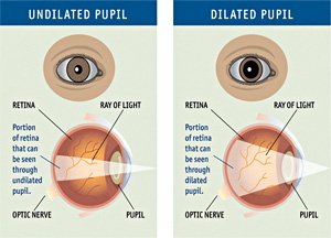 31184_dilated-pupils.jpg